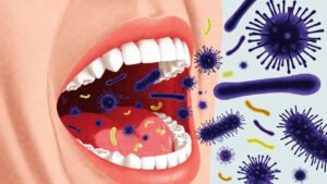 Why Your Mouth Feels Like a Battlefield – Fix It Before It’s Too Late